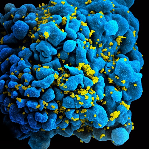 ../_images/HIV-infected-TCell.jpg