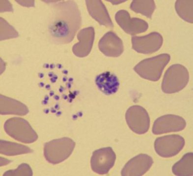 ../_images/malaria-blood-smear.jpg